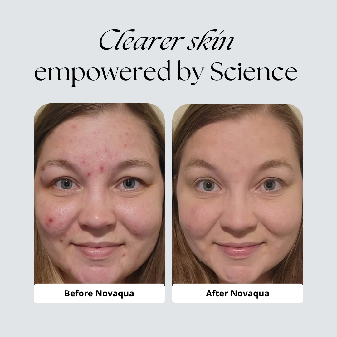 Novaqua™ | Showerhead